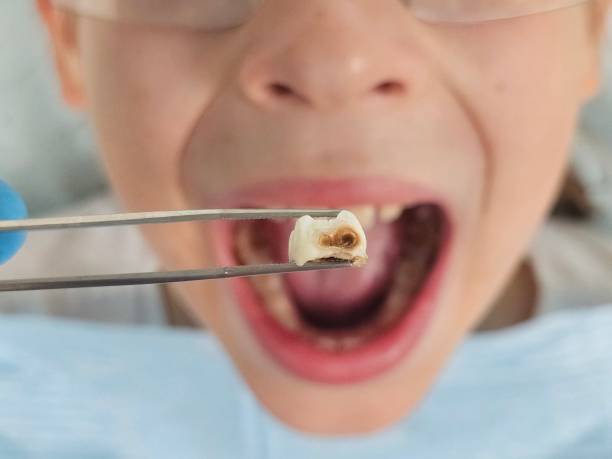 Best Urgent Dental Care for Toothache in Ronceverte, WV