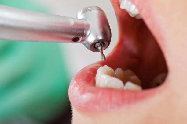 Best Emergency Dentist for Knocked-Out Tooth in Ronceverte, WV
